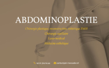 Abdominoplastie Lausanne, questions et réponses